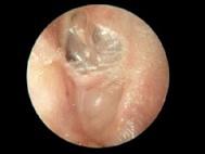 卫生招聘（耳鼻喉科汇总）,章节练习,基础复习,耳科学