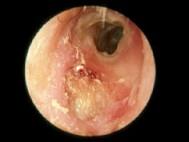 卫生招聘（耳鼻喉科汇总）,章节练习,基础复习,耳科学