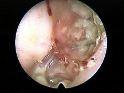 卫生招聘（耳鼻喉科汇总）,章节练习,基础复习,耳科学
