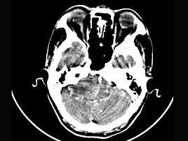 卫生招聘（耳鼻喉科汇总）,章节练习,基础复习,耳科学