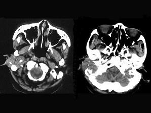 卫生招聘(耳鼻喉科汇总),章节练习,基础复习,耳科学 卫生招聘(耳鼻喉科汇总),章节练习,基础复习,耳科学