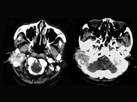 卫生招聘(耳鼻喉科汇总),章节练习,基础复习,耳科学 卫生招聘(耳鼻喉科汇总),章节练习,基础复习,耳科学