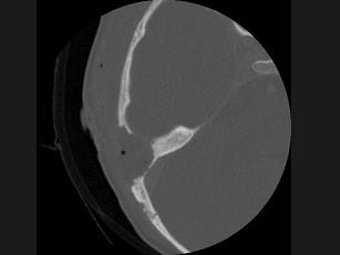 卫生招聘(耳鼻喉科汇总),章节练习,基础复习,耳科学 卫生招聘(耳鼻喉科汇总),章节练习,基础复习,耳科学