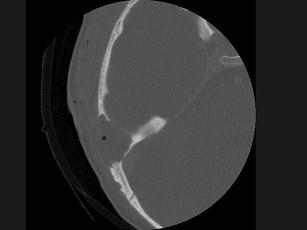 卫生招聘(耳鼻喉科汇总),章节练习,基础复习,耳科学 卫生招聘(耳鼻喉科汇总),章节练习,基础复习,耳科学