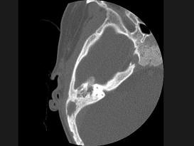卫生招聘(耳鼻喉科汇总),章节练习,基础复习,耳科学 卫生招聘(耳鼻喉科汇总),章节练习,基础复习,耳科学