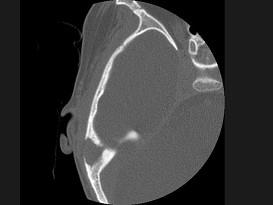 卫生招聘(耳鼻喉科汇总),章节练习,基础复习,耳科学 卫生招聘(耳鼻喉科汇总),章节练习,基础复习,耳科学