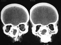 卫生招聘（耳鼻喉科汇总）,章节练习,基础复习,鼻科学