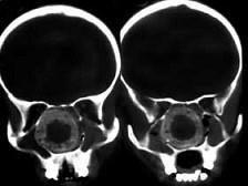 卫生招聘（耳鼻喉科汇总）,章节练习,基础复习,鼻科学