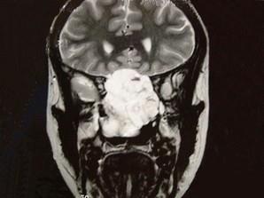 卫生招聘（耳鼻喉科汇总）,章节练习,基础复习,鼻科学