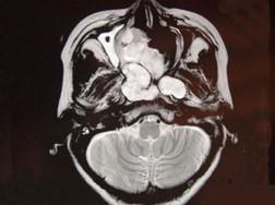 卫生招聘（耳鼻喉科汇总）,章节练习,基础复习,鼻科学