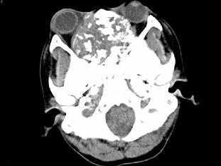 卫生招聘（耳鼻喉科汇总）,章节练习,基础复习,鼻科学