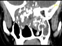 卫生招聘（耳鼻喉科汇总）,章节练习,基础复习,鼻科学