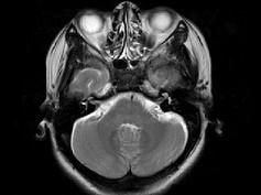 卫生招聘（耳鼻喉科汇总）,章节练习,基础复习,鼻科学