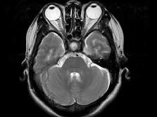 卫生招聘（耳鼻喉科汇总）,章节练习,基础复习,鼻科学