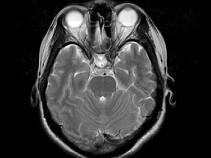 卫生招聘（耳鼻喉科汇总）,章节练习,基础复习,鼻科学