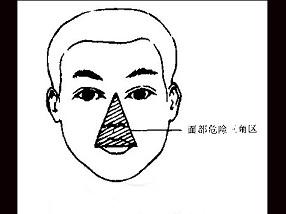 卫生招聘（耳鼻喉科汇总）,章节练习,基础复习,鼻科学