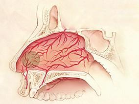 卫生招聘（耳鼻喉科汇总）,章节练习,基础复习,鼻科学