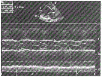 军队文职医学影像技术,章节练习,基础复习,超声诊断,专业实践能力强化练习