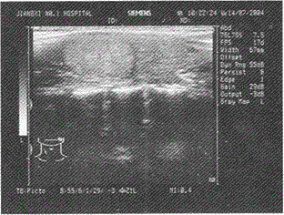 军队文职医学影像技术,章节练习,基础复习,超声诊断,专业实践能力强化练习