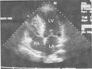 军队文职医学影像技术,章节练习,基础复习,超声诊断,相关专业知识强化练习 军队文职医学影像技术,章节练习,基础复习,超声诊断,相关专业知识强化练习