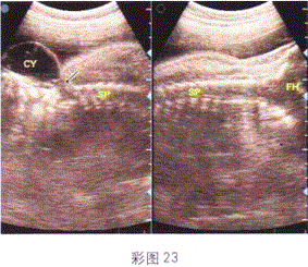 军队文职医学影像技术,章节练习,基础复习,超声诊断,专业实践能力强化练习