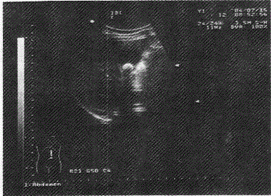 军队文职医学影像技术,章节练习,基础复习,超声诊断,专业实践能力强化练习 军队文职医学影像技术,章节练习,基础复习,超声诊断,专业实践能力强化练习