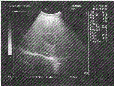 军队文职医学影像技术,章节练习,基础复习,超声诊断,专业实践能力强化练习