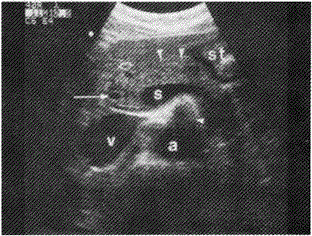 军队文职医学影像技术,章节练习,基础复习,超声诊断,专业实践能力强化练习 军队文职医学影像技术,章节练习,基础复习,超声诊断,专业实践能力强化练习