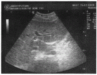 军队文职医学影像技术,章节练习,基础复习,超声诊断,相关专业知识强化练习 军队文职医学影像技术,章节练习,基础复习,超声诊断,相关专业知识强化练习