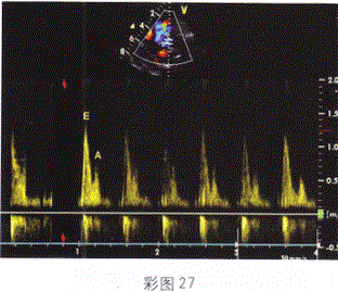 军队文职医学影像技术,章节练习,基础复习,超声诊断,相关专业知识强化练习