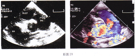 军队文职医学影像技术,章节练习,基础复习,超声诊断,专业知识强化练习