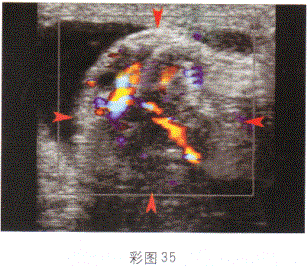 军队文职医学影像技术,章节练习,基础复习,超声诊断,强化练习