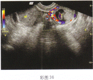 军队文职医学影像技术,章节练习,基础复习,超声诊断,强化练习