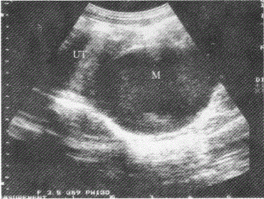 军队文职医学影像技术,章节练习,基础复习,超声诊断,强化练习