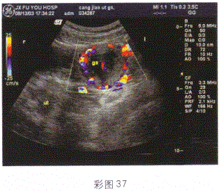 军队文职医学影像技术,章节练习,基础复习,超声诊断,强化练习
