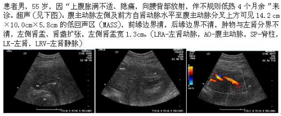 军队文职医学影像技术,历年真题,军队文职人员招聘考试《医学影像技术》真题精选