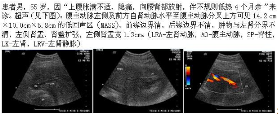 军队文职医学影像技术,历年真题,军队文职人员招聘考试《医学影像技术》真题精选